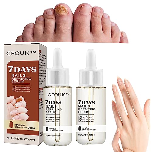7 Days Nails Repairing Serum,Nail Serum For Growth And Repair For Damaged Nails,Nail Repair Oil Solution,Stronger Nails In 1 Week Nail Strengthening Treatment(2pcs)